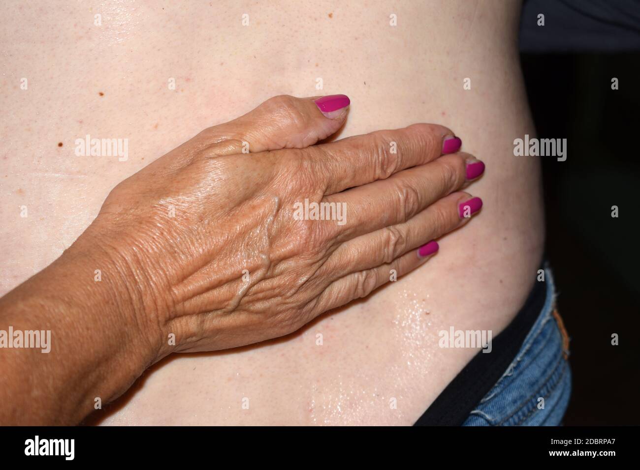 Hand resting on swelling of the back Stock Photo