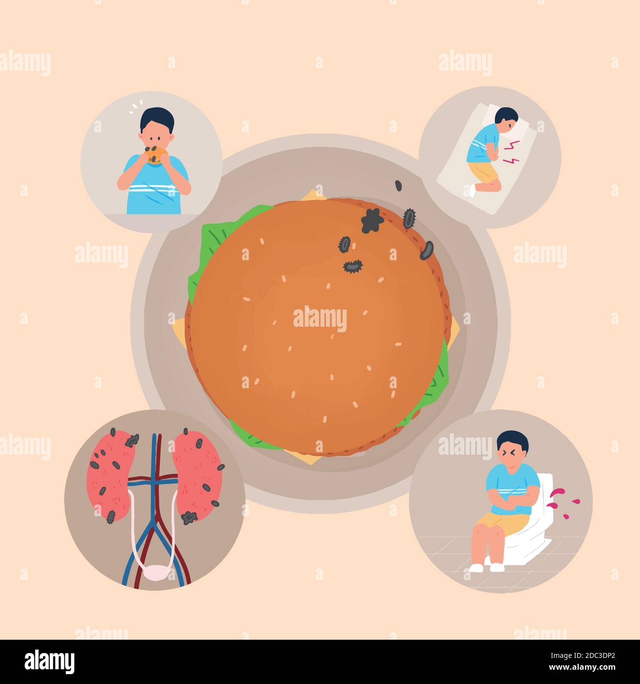 Fast food harmful effects, diseases caused by hamburger illustration 006 Stock Vector Image