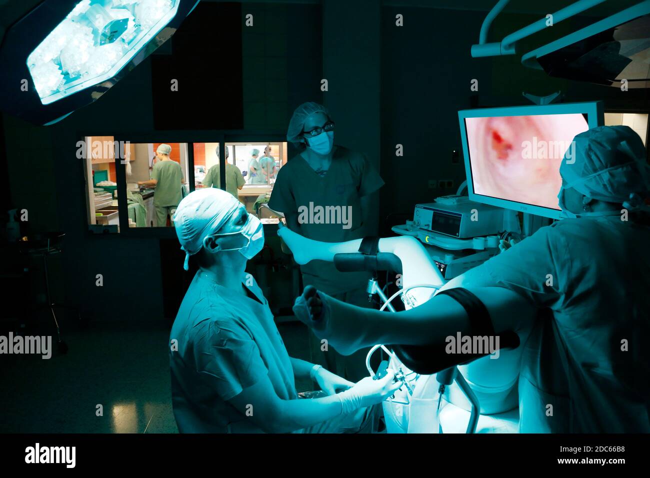 gynecologist during laparoscopic surgery in the operating room of a hospital Stock Photo