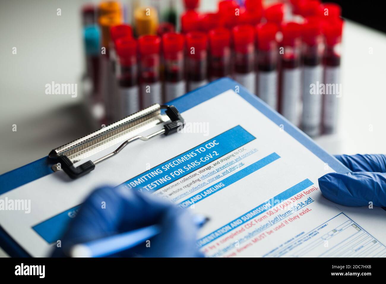Lab technician filling out specimen submitting form,laboratory testing for SARS-CoV-2 novel corona virus disease,closeup of hands in gloves holding Stock Photo