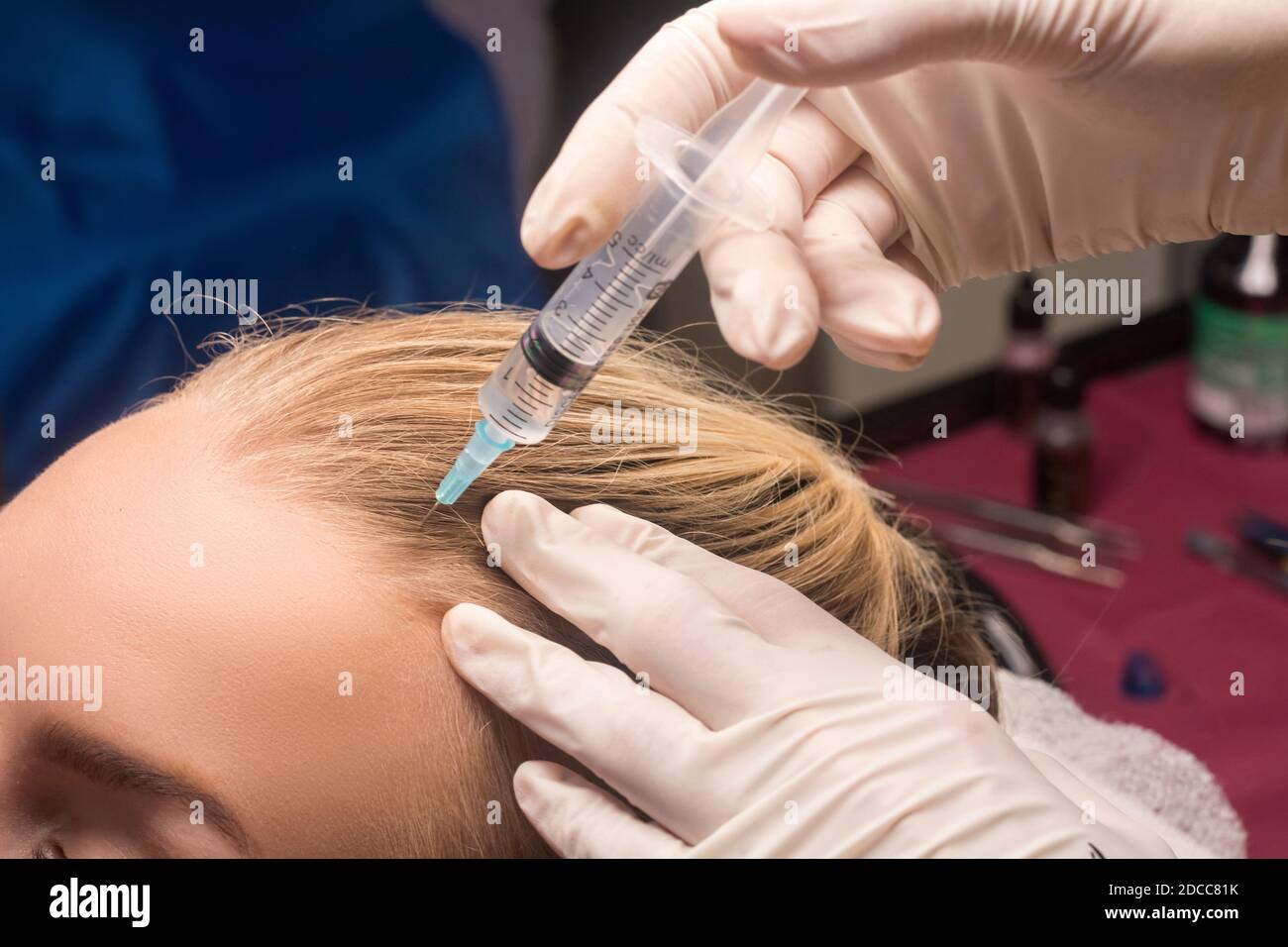 Hair mesotherapy. The process of a medical procedure in the salon Stock Photo