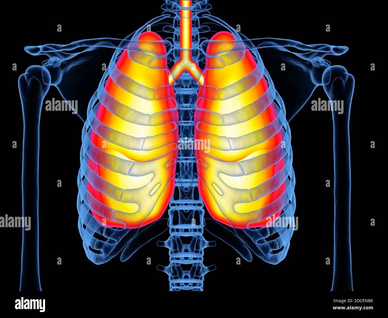 Chest x ray asthma hires stock photography and images Alamy