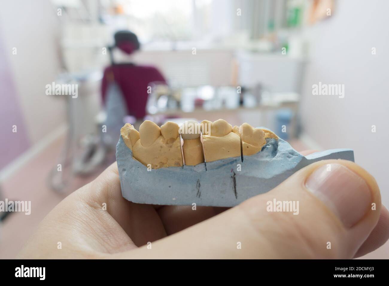 modern nylon dental prosthesis in the hands of a doctor Stock Photo