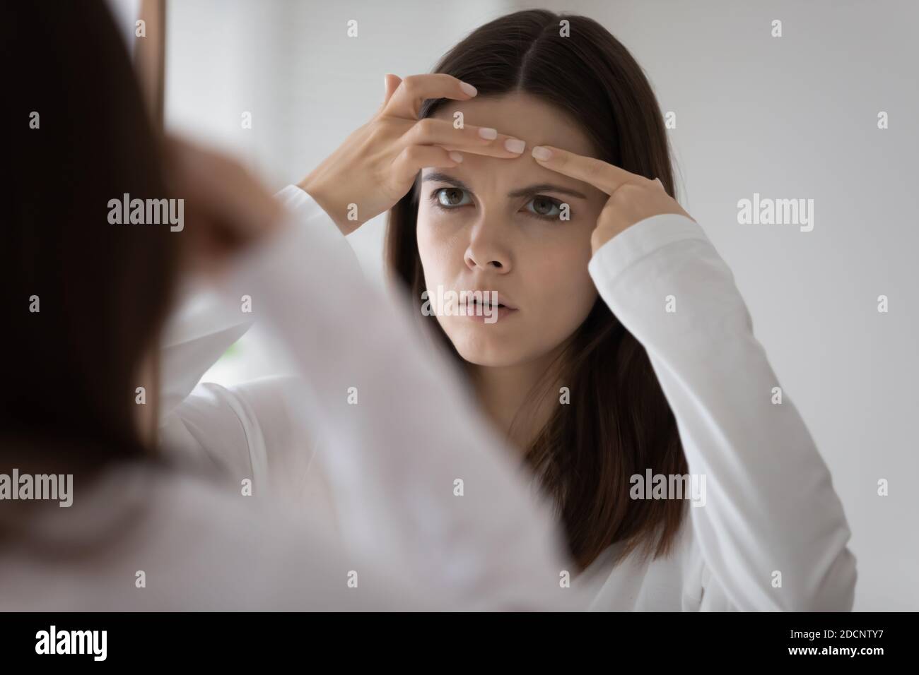 Worried young woman annoyed of bad face skin condition Stock Photo Alamy
