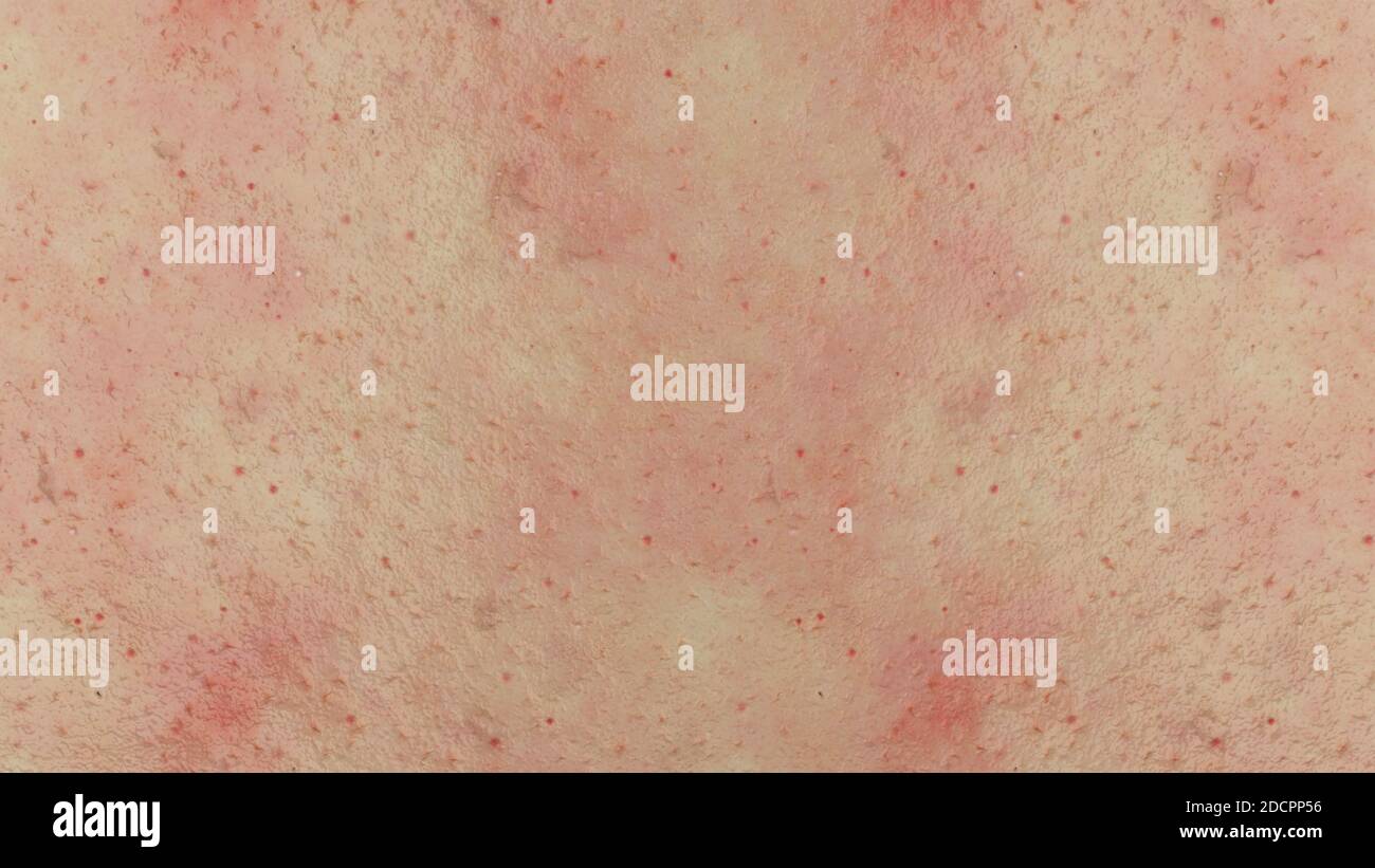 Dermatology covering hi-res stock photography and images - Alamy