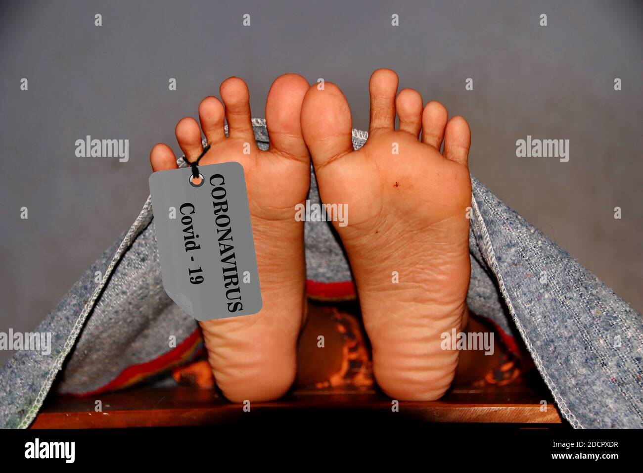 Not focus and noise image, concept imitation morgue, coronavirus victim killed by 2019-ncov, legs of a corpse on a table, people died Stock Photo