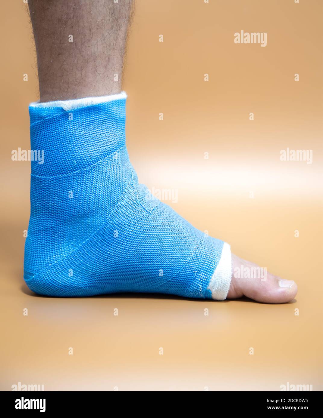 Blue splint ankle. Bandaged leg cast on male patient on colored blurred