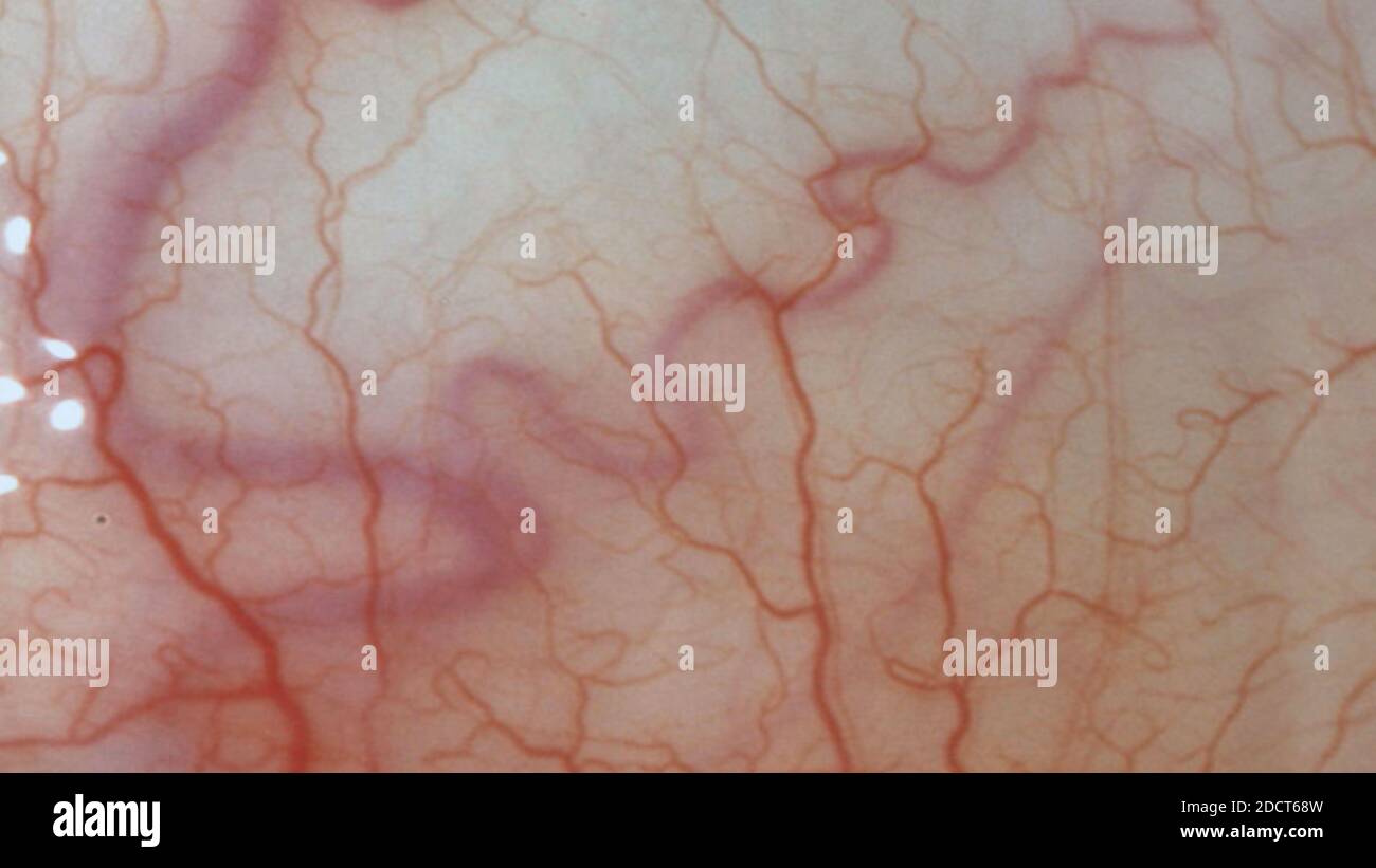 for medical knowledge Human eyes close up image with veins. Stock Photo