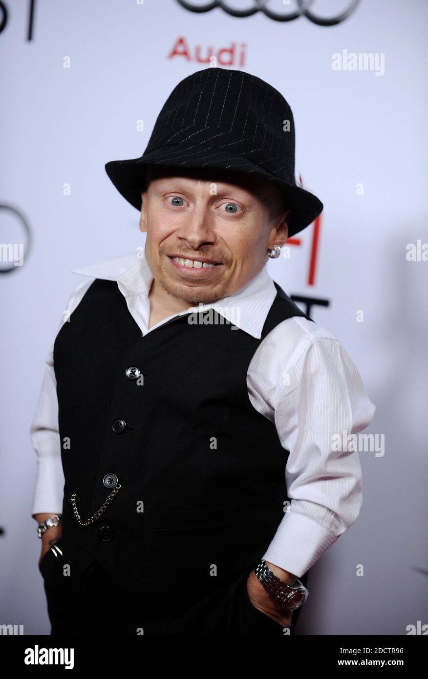 Verne Troyer Harry Potter
