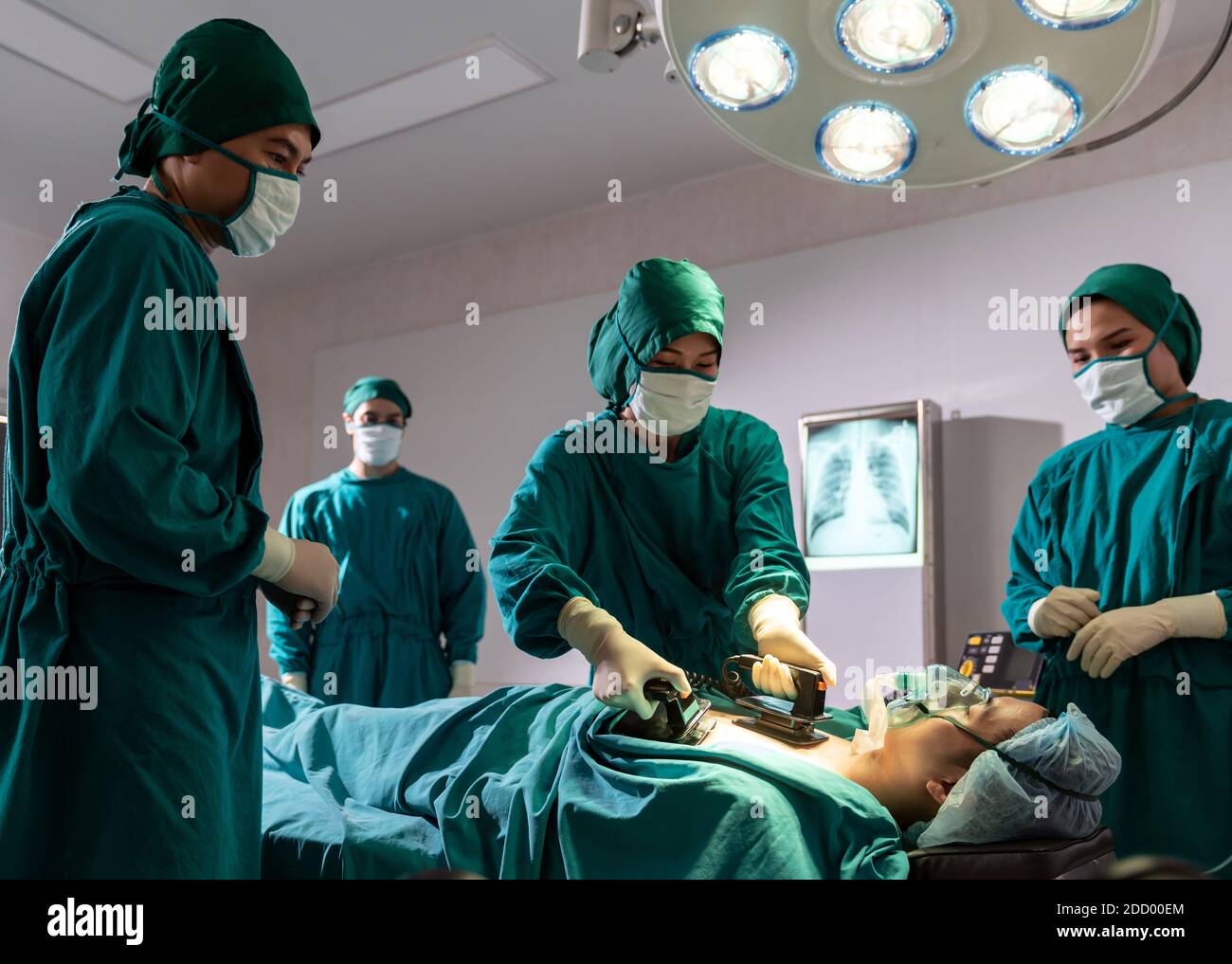 Surgeon doctor and nurse using Defibrillator to patient while patient have problem with Sudden Cardiac Arrest while surgery in Operating Room OR. Medi Stock Photo