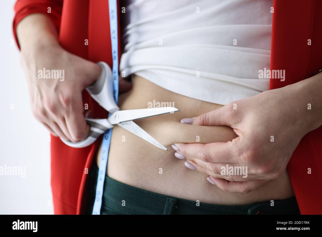 Woman grabbing skin on her flanks with black color crosses marking, Lose  weight and liposuction cellulite removal concept, Isolated on white  backgroun Stock Photo - Alamy