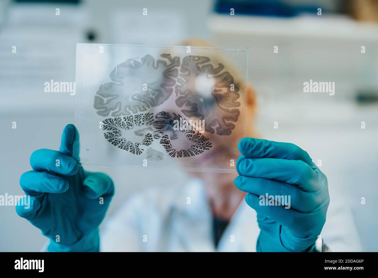 Scientist holding human brain microscope slide while standing at laboratory Stock Photo