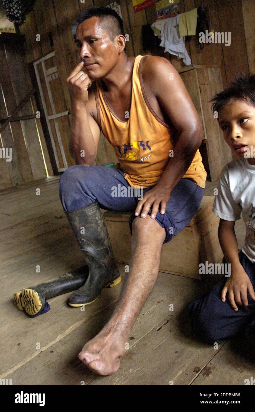 NO FILM, NO VIDEO, NO TV, NO DOCUMENTARY - Luis Jempekat, a Shuar indian and father of five, shows the damage a landmine did to his left foot while living in the Tiwintza district, of Santiago, Ecuador, on Sunday 20, 2005. Photo by Marice Cohn Band/Miami Herald/KRT/ABACAPRESS.COM Stock Photo