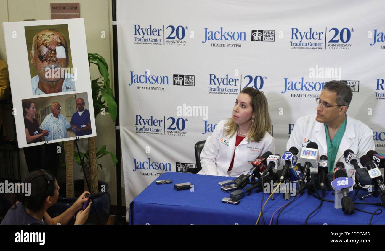 NO FILM, NO VIDEO, NO TV, NO DOCUMENTARY - Wrood Kassira and Nicholas Namias, right, discuss Ronald Poppo&apos;s condition and treatment options at a news conference at Ryder Trauma Center at Jackson Memorial Hospital on Tuesday, June 12, 2012, in Miami, Florida. Poppo, a homeless man who had his face mostly chewed off in a bizarre attack by Rudy Eugene. Photo by Tessa Lighty/Miami Herald/MCT/ABACAPRESS.COM Stock Photo