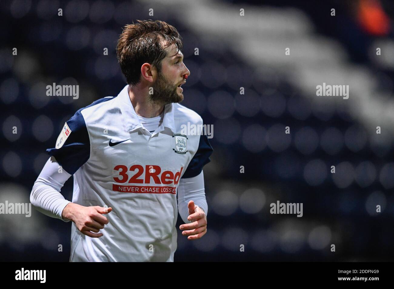 Tom Barkhuizen #29 of Preston North End with a bloody nose plug after receiving an injury on the pitch Stock Photo