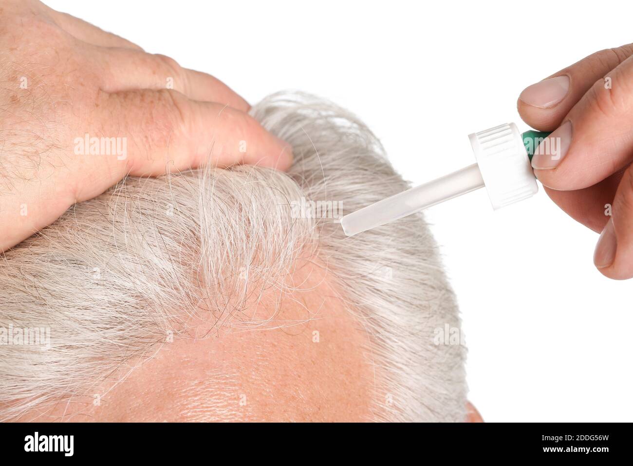 Senior man using serum for hair loss treatment on white background, closeup Stock Photo - Alamy Senior man using serum for hair loss treatment on white background, closeup Stock Photo - Alamy