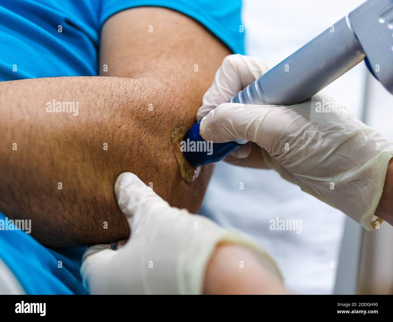 Ultrasound probe hi-res stock photography and images - Alamy
