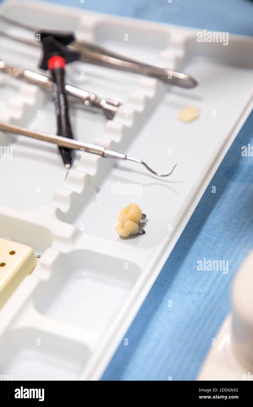 High angle of small artificial teeth placed on table with various dental instruments in clinic Stock Photo