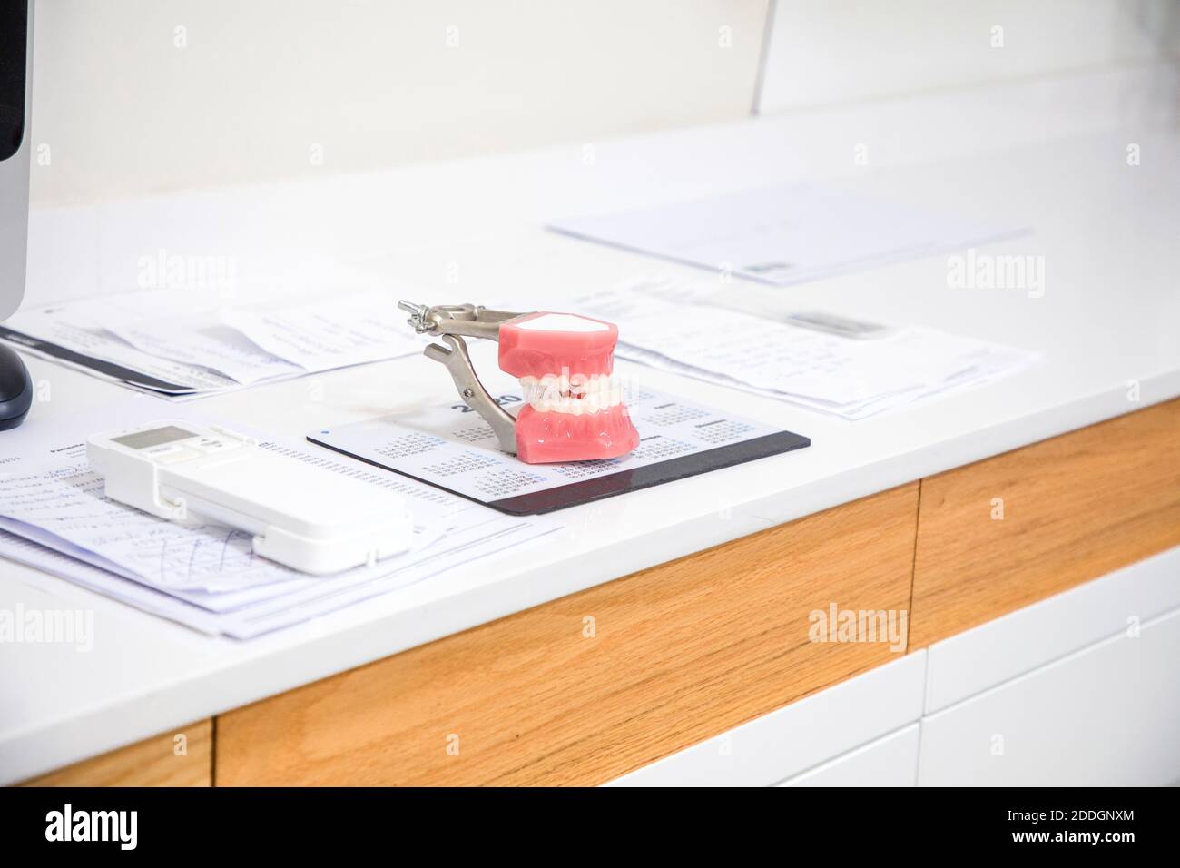 Closeup of white dental cast placed on white surface in modern ...