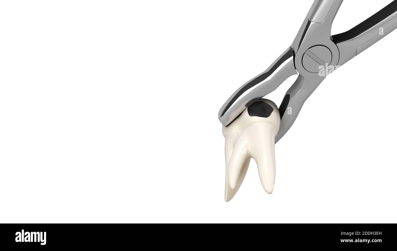 tooth clamped in medical extraction forceps dental services concept 3d