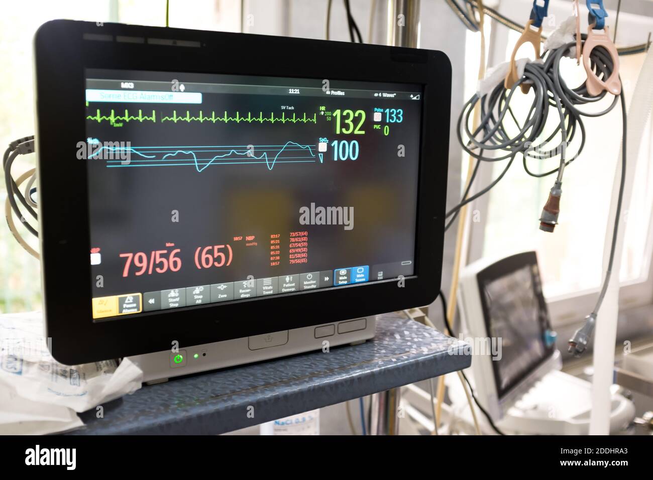 Electrocardiograph (ECG or EKG) unit in a hospital emergency room, black monitor screen showing heart rate & pulse,COVID-19 coronavirus USA pandemic Stock Photo