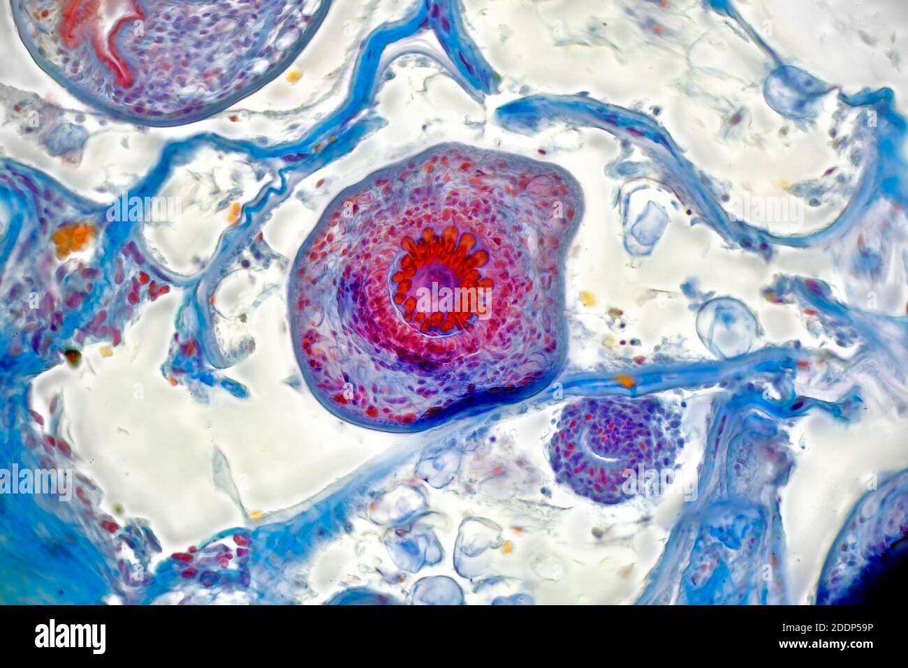 brightfield photomicrograph, dog tapeworm parasite deatail, encysted