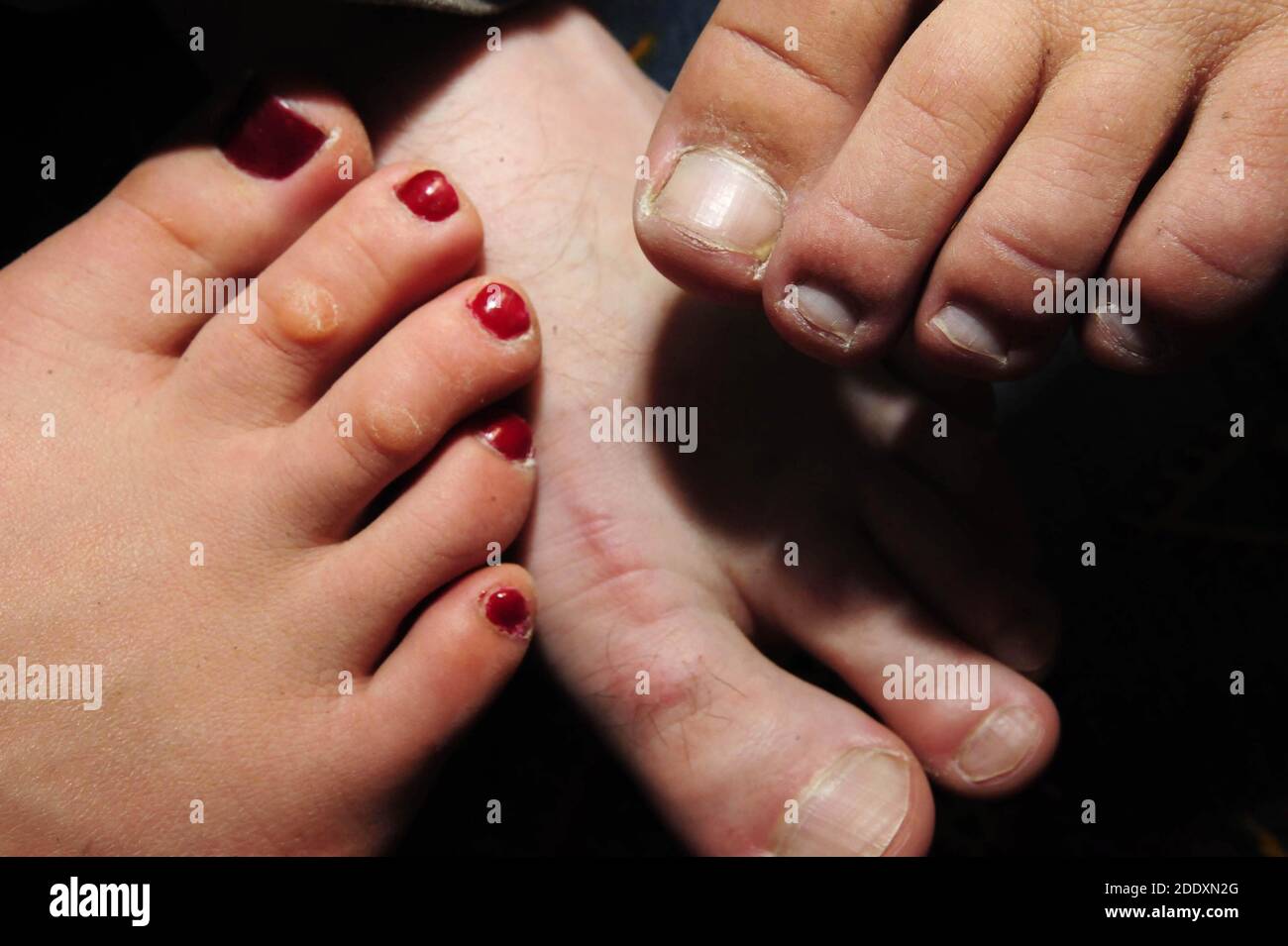 Ordinary Female Feet With Painted Nails. Fetish Stock Photo, Picture and  Royalty Free Image. Image 140544821.