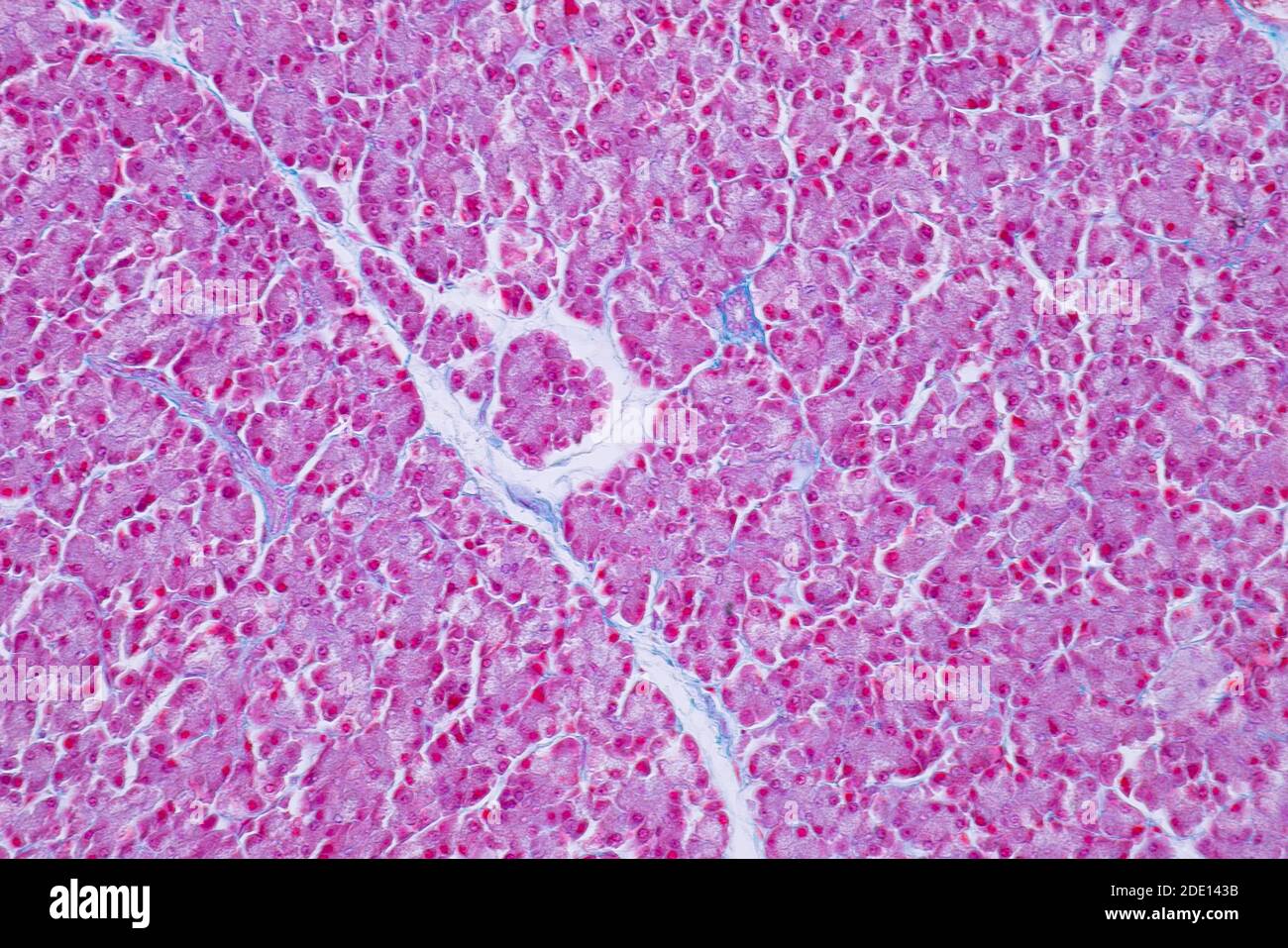 Human liver tissue, light micrograph Stock Photo