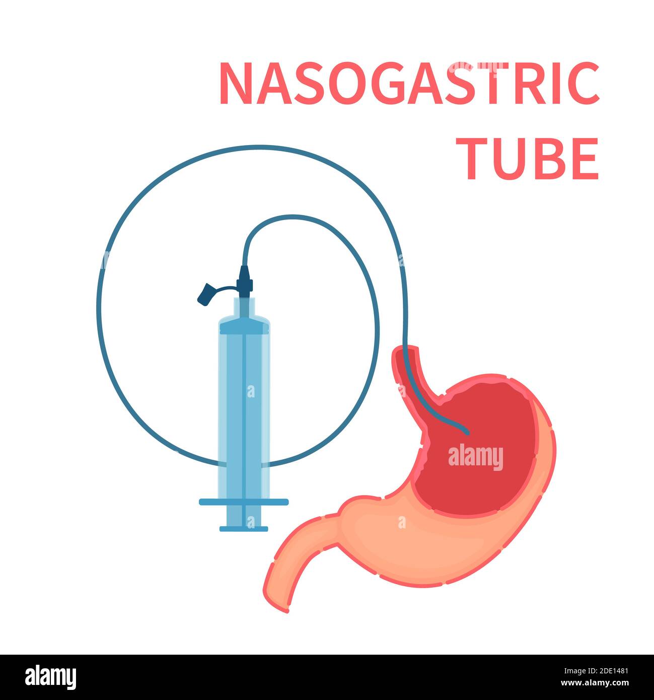 nasogastric-tube-hi-res-stock-photography-and-images-alamy