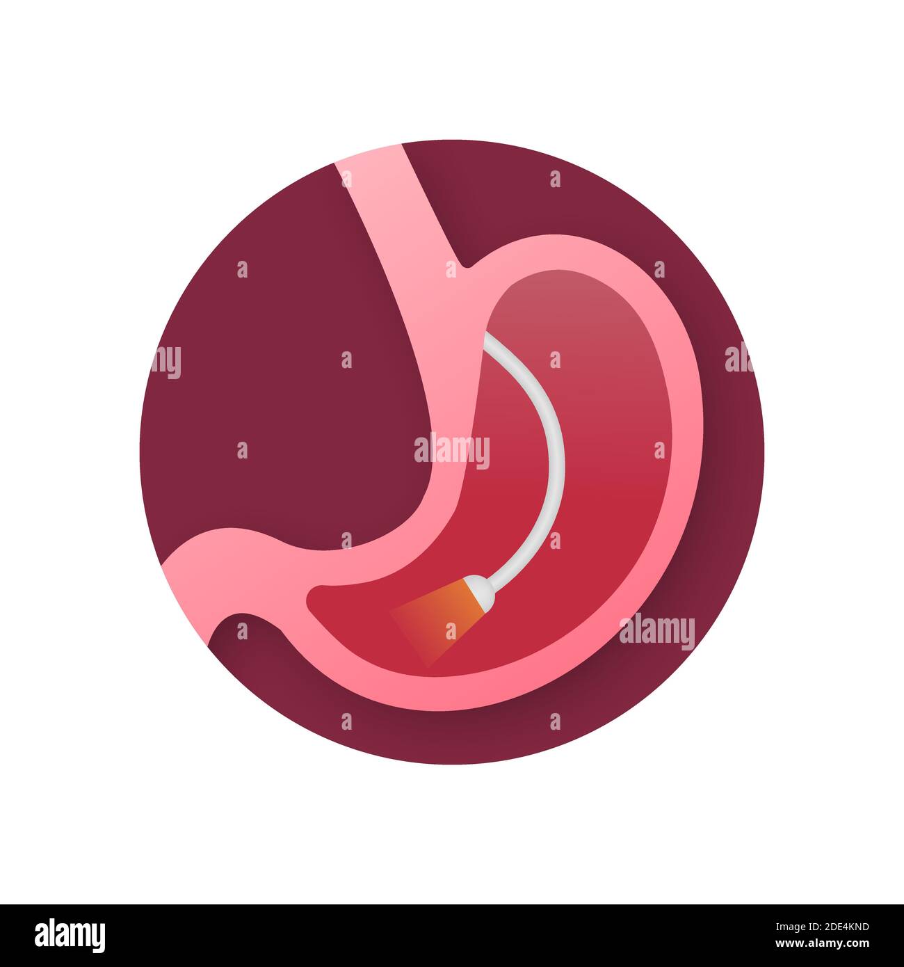 Esophagus endoscopy healthy hires stock photography and images Alamy