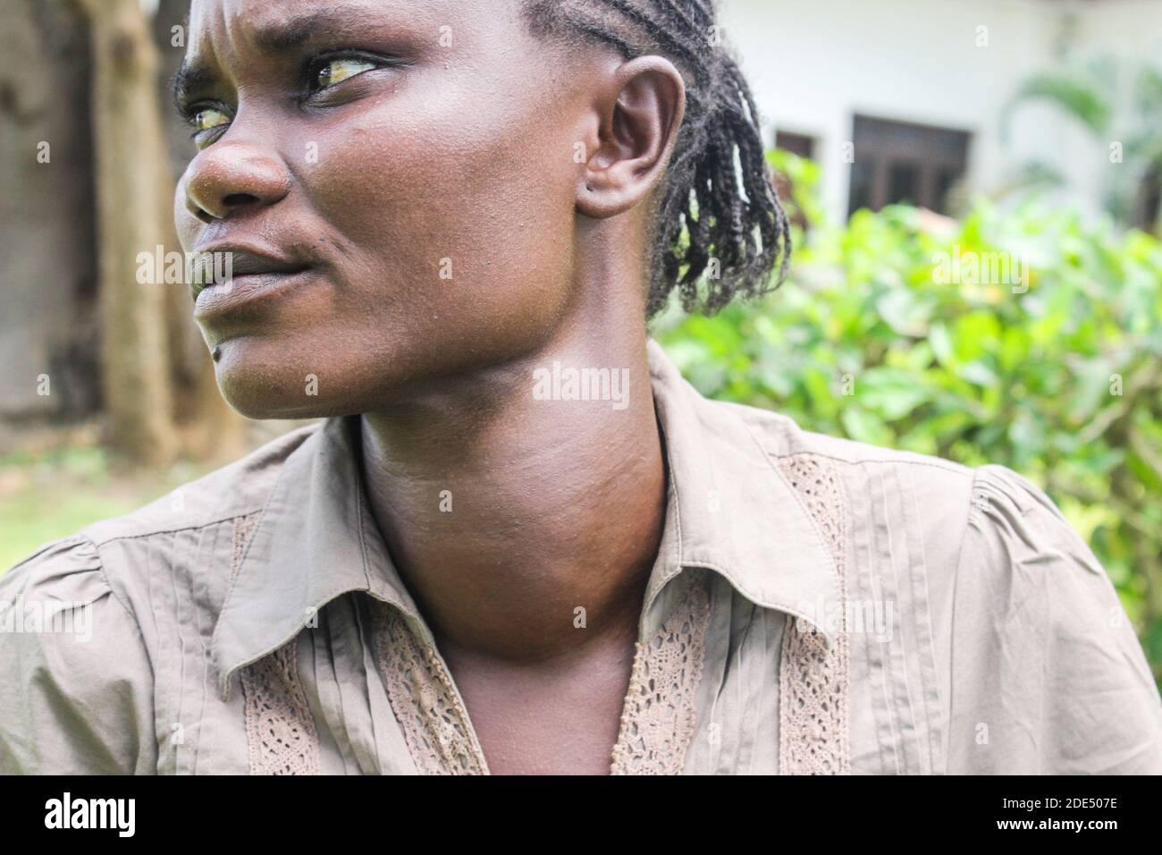 Irine Akinyi, 28 year old, a victim of lead poisoning in Uwino Uhuru