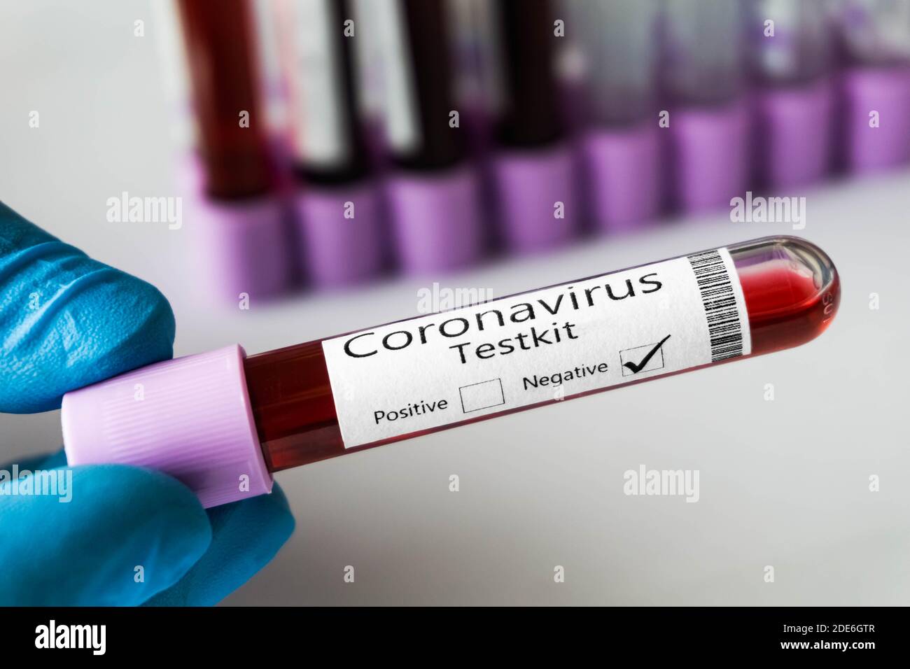 Top view of test tube containing blood sample negative for novel coronavirus outbreak. Covid-19 pandemic. Stock Photo