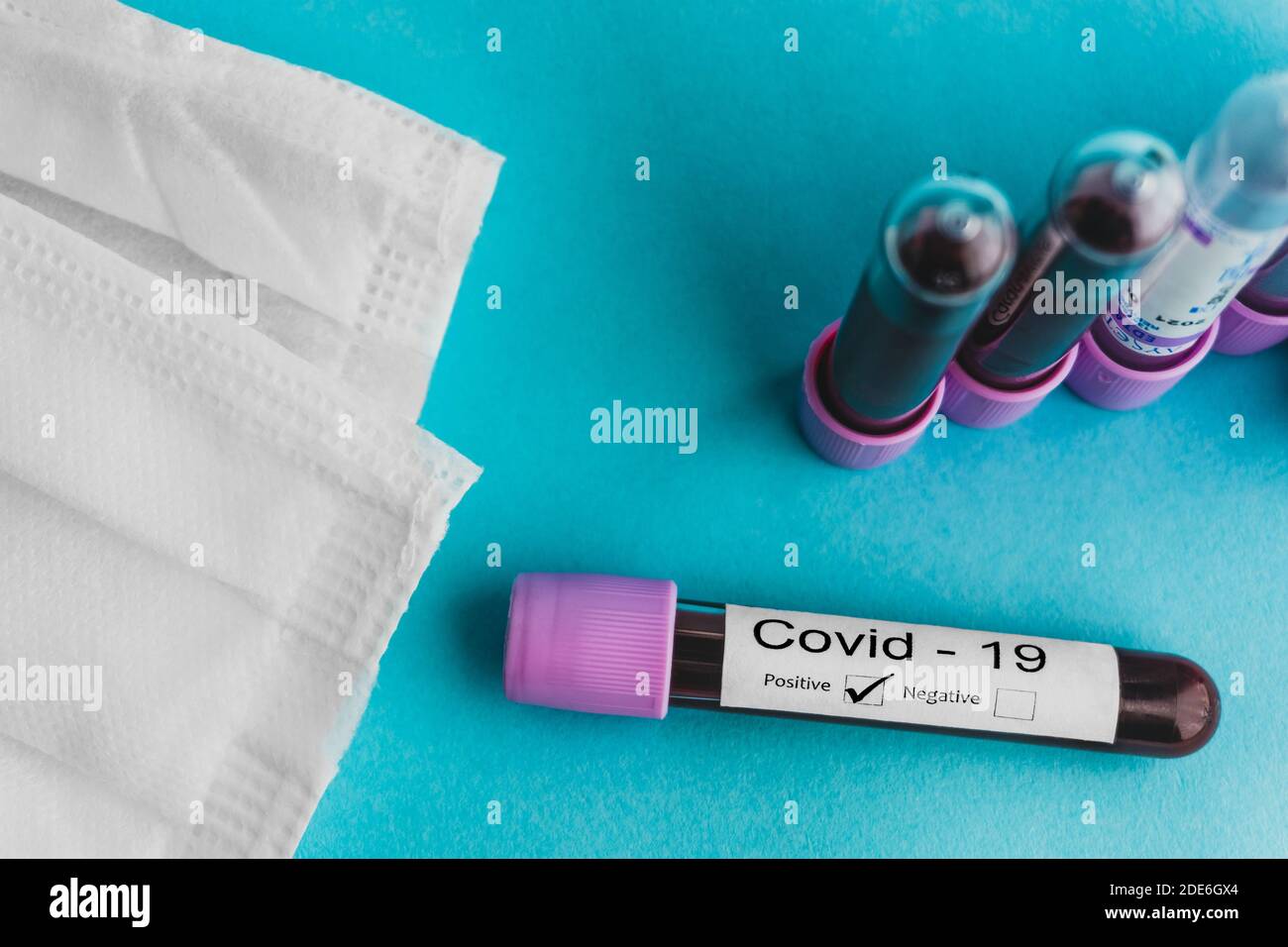 Conceptual photo for coronavirus outbreak. Positive blood test sample. Medical face mask, test tubes with blood sample. Stock Photo