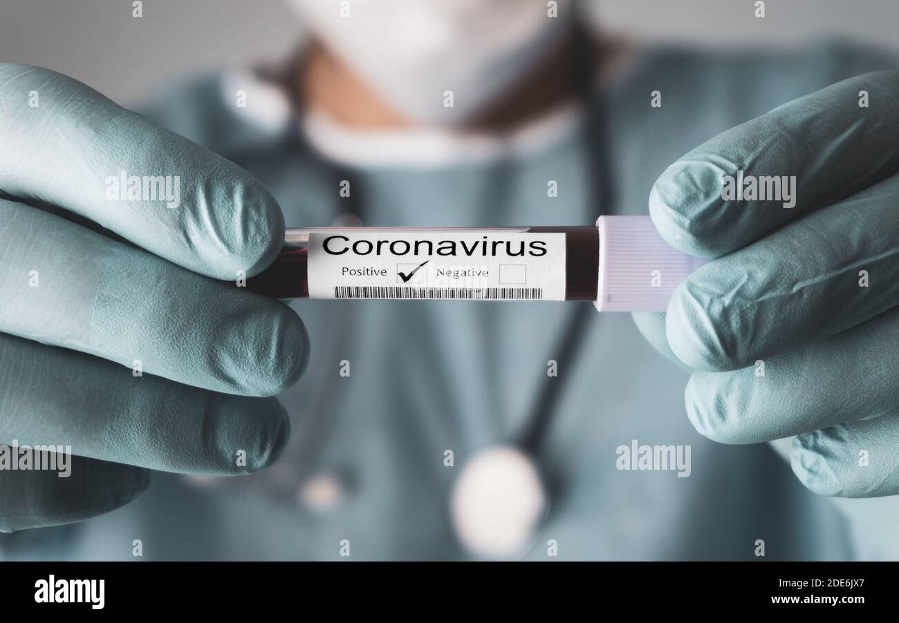 Positive result of the Coronavirus test, Covid-19. Doctor showing the result of blood test. 2019 Novel Coronavirus concept. Stock Photo