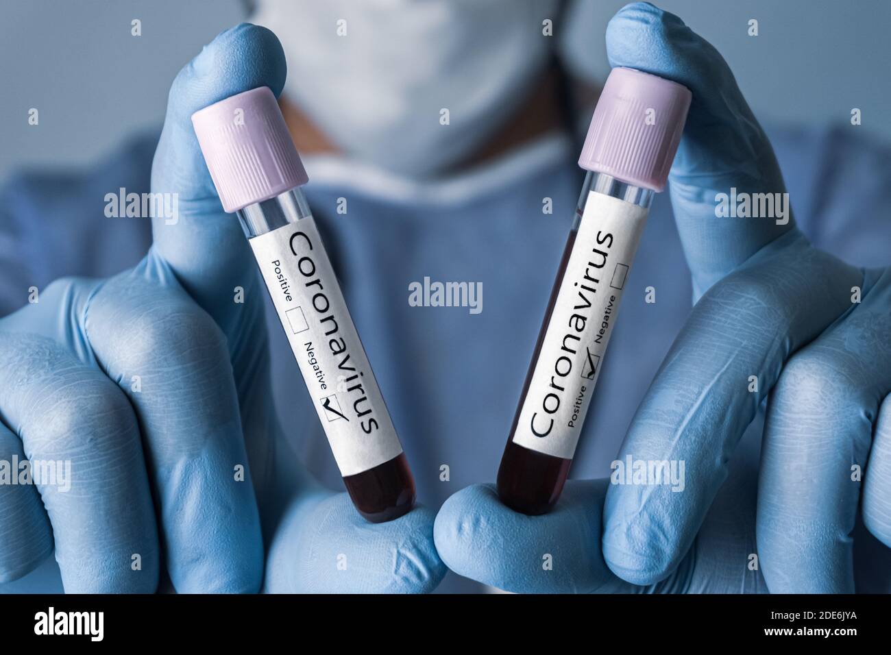 COVID-19 test and laboratory sample of blood testing for diagnosis new Corona virus infection. Positive and Negative results. Coronavirus concept. Stock Photo