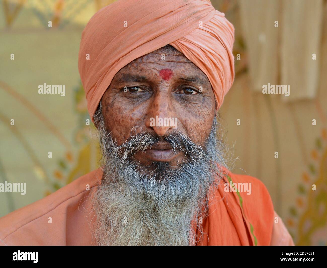 Middle-aged Indian Hindu holy man (sadhu, baba, guru) with skin blemishes on his face looks straight at the viewer, during the Shivratri Mela. Stock Photo