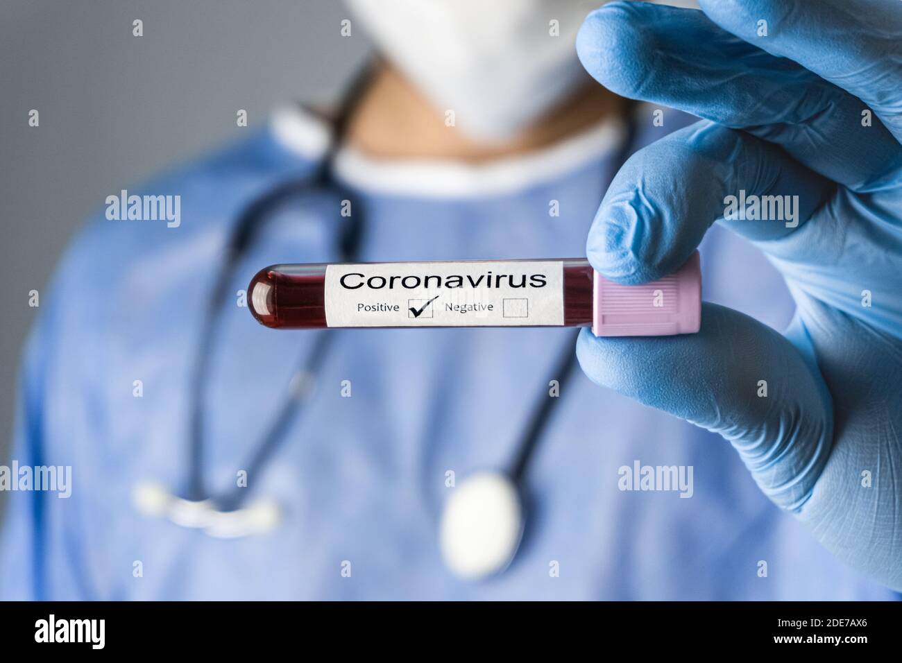 The doctor is showing a coronavirus positive blood test sample with a stethoscope, protective clothing and medical mask. Stock Photo