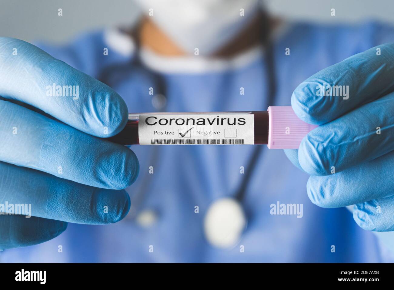 Doctor holding test tube with Positive Coronavirus test blood sample. Covid-19 concept. Stock Photo