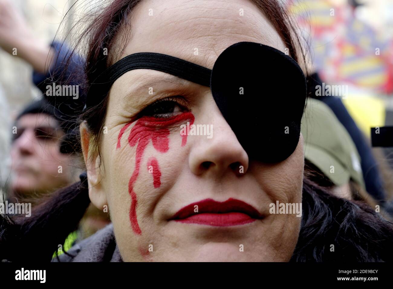 Yellow Vests protester wear a eye patch on their eyes depicting French Gilet  Jaune movement leader Jerome Rodrigues with an eye injury shot by French  Police , on the sidelines of a
