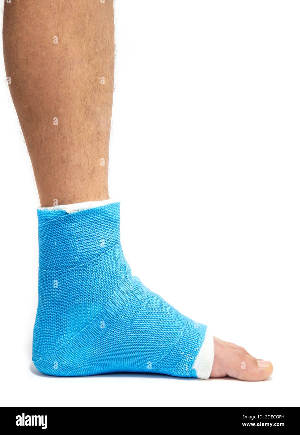 Blue splint ankle. Bandaged leg cast on male patient on white