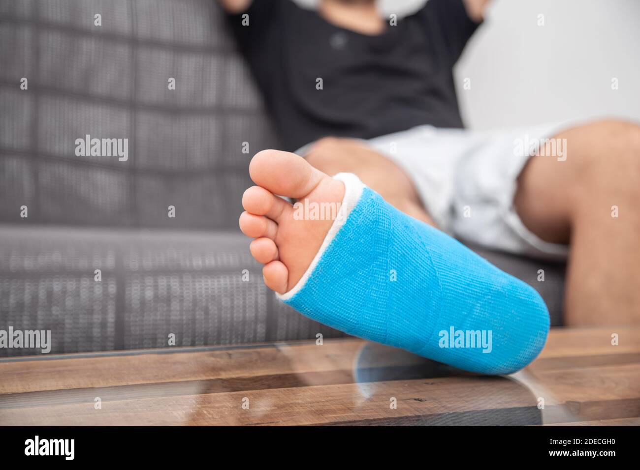 Man with broken leg in cast on couch at home. Sports injury concept
