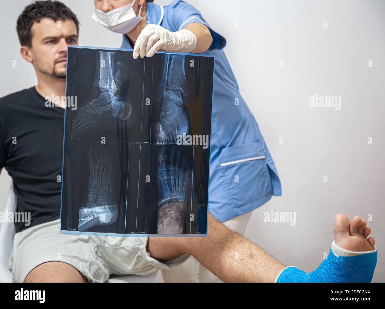 Lower leg fracture x ray hi-res stock photography and images - Alamy