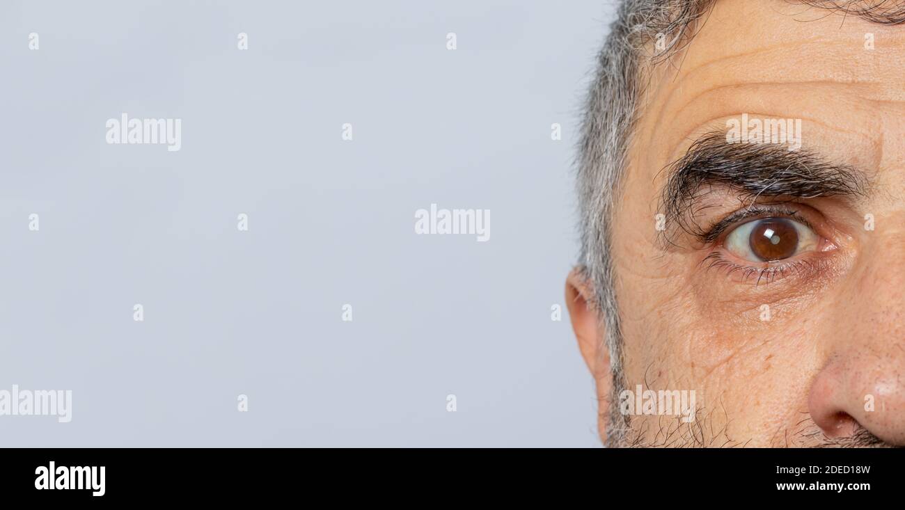 A man on a gray background banner with a place for text. Cataract - a disease of the human eye, clouding of the lens. Ophthalmology. Stock Photo