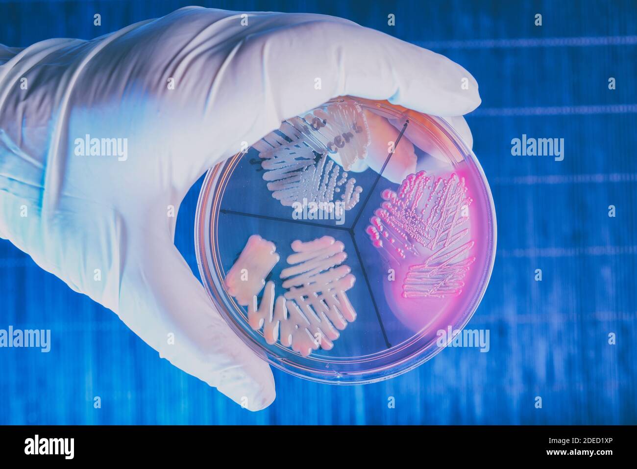 Hand in glove holding Petri plate with bacteria Escherichia Coli, Klebisiella Pneumoniae, Serratia Marascens Stock Photo