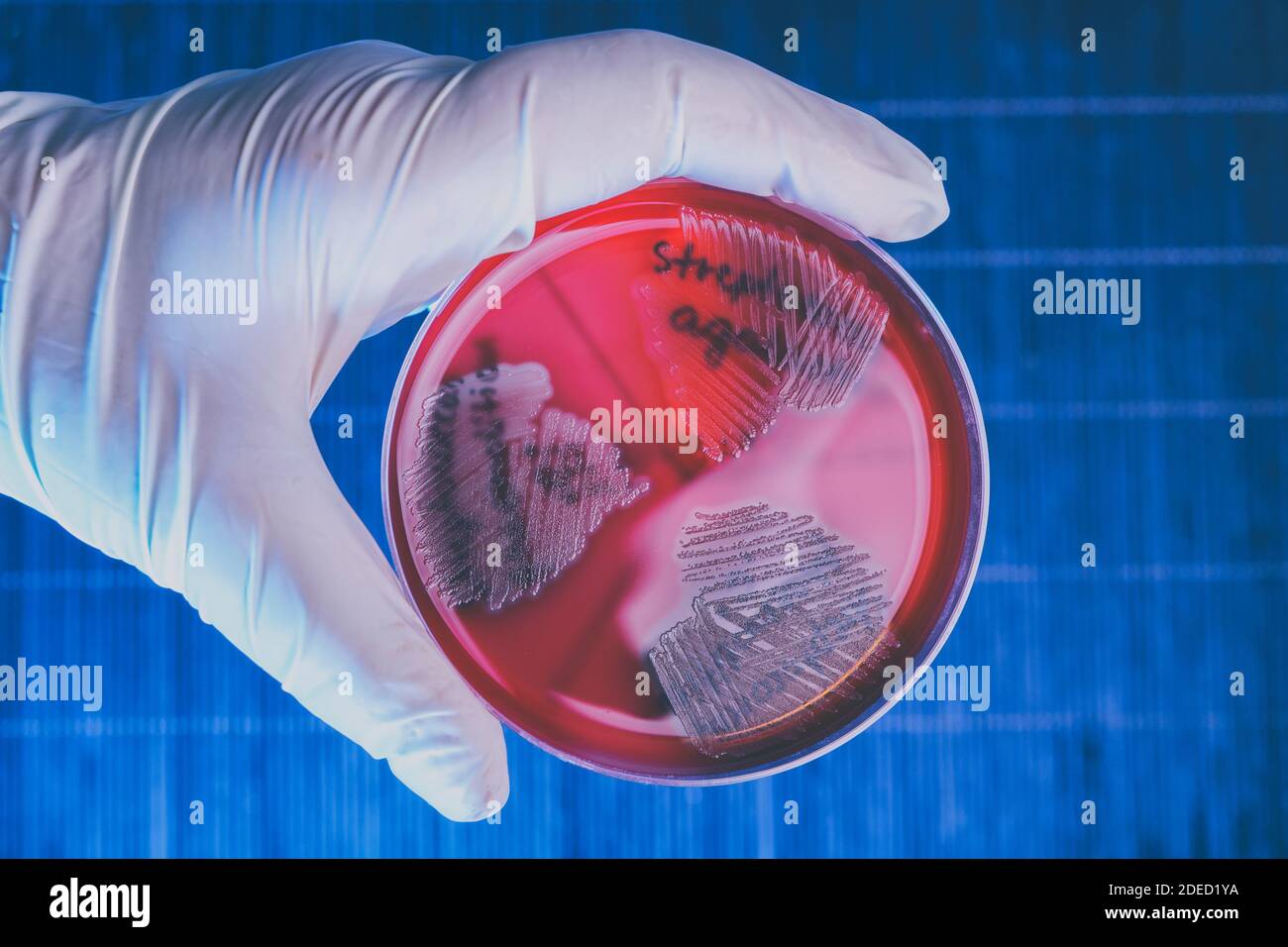 Hand in glove holding Petri plate with bacteria Steptococcus Phaemolifticus G, Streptococcus Agalactiae, Streptococcus Phaemolifticus Stock Photo