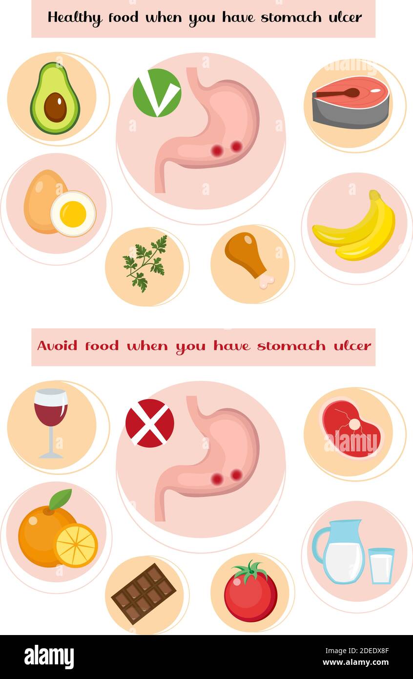 Healthy and avoid food if you have stomach ulcer infographics. Prevention of stomach diseases. Medicine concept. Vector illustration Stock Vector