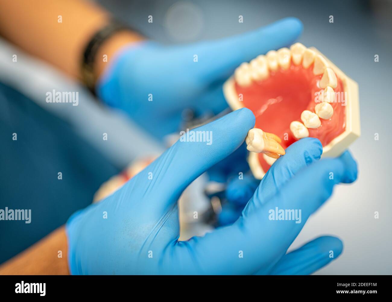 Dental prosthesis, dentures, prosthetics work. Prosthetics hands while working on the denture. Stock Photo