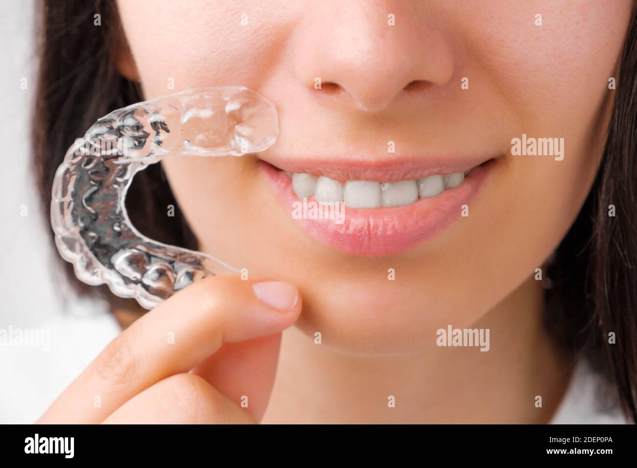 Close up woman holding a transparent removable braces for perfect smile. Orthodontic aligners for straightening and whitening teeth. Stock Photo