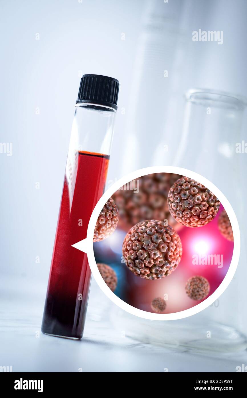 Medical test tube with blood sample for herpes virus laboratory medical