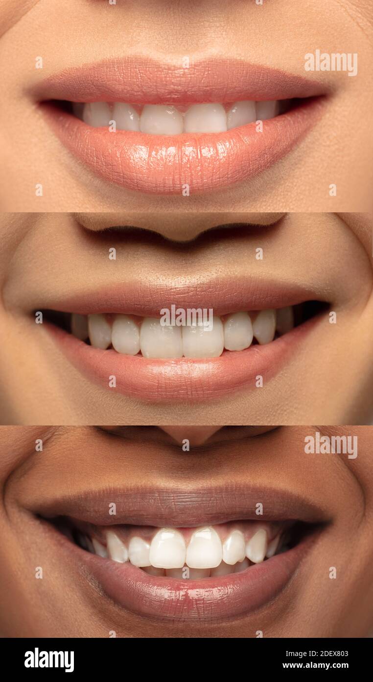 Smile. Close up female lips. Faces of beautiful multiethnic young